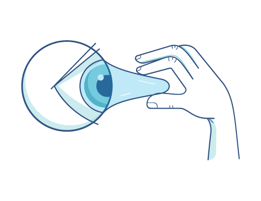 Чи можуть контактні лінзи прилипнути до очей?